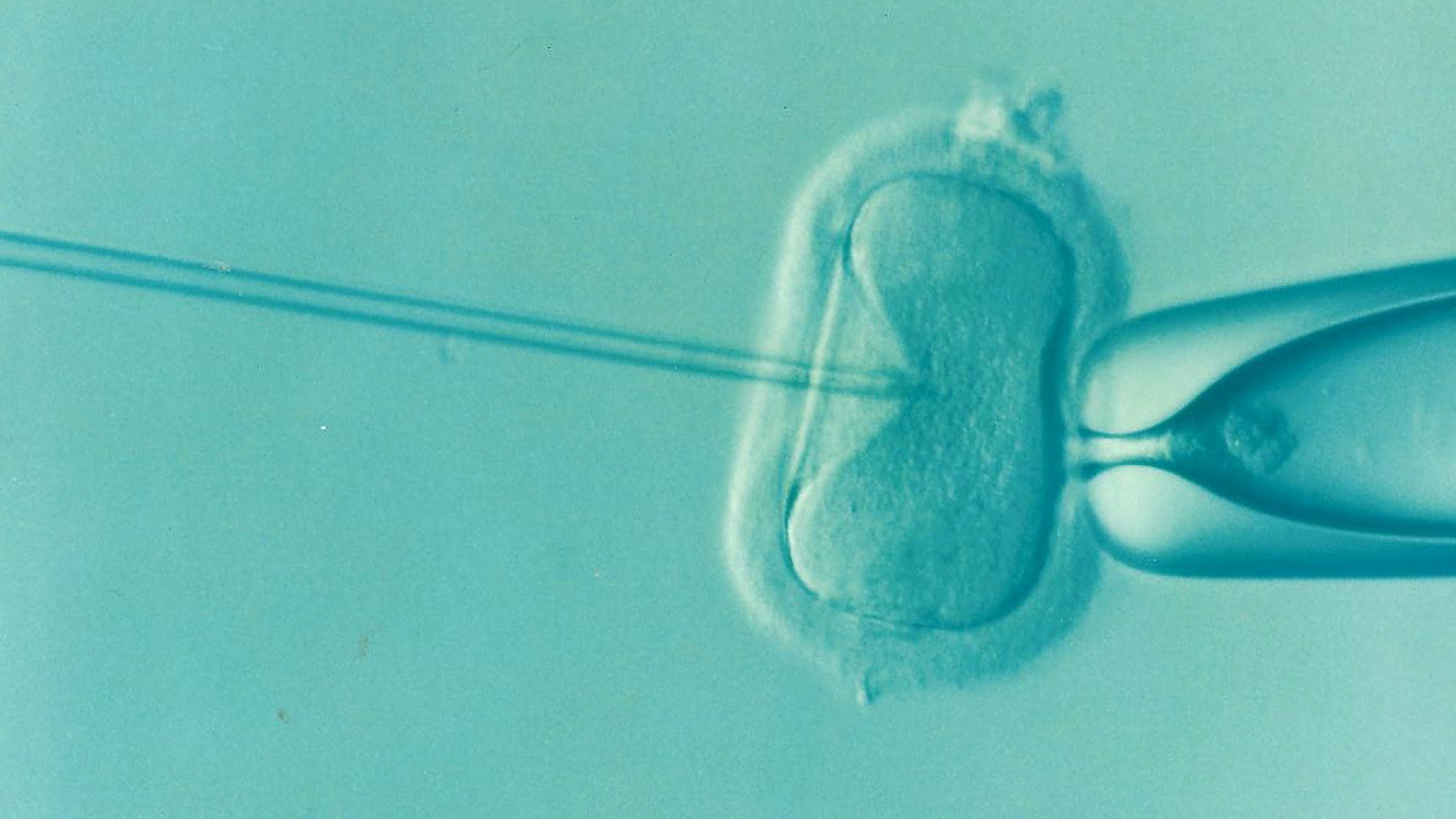 Lire la suite à propos de l’article Parcours en Procréation Médicalement Assistée : des créneaux dédiés à partir du 1er Septembre 2022